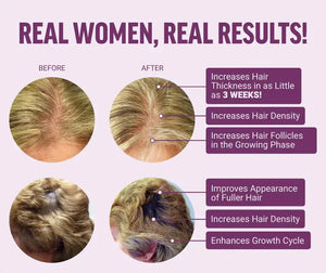Hair Growth Accelerator Biotin Supplement featuring Zinc and Veggie Caps & Soft Chews