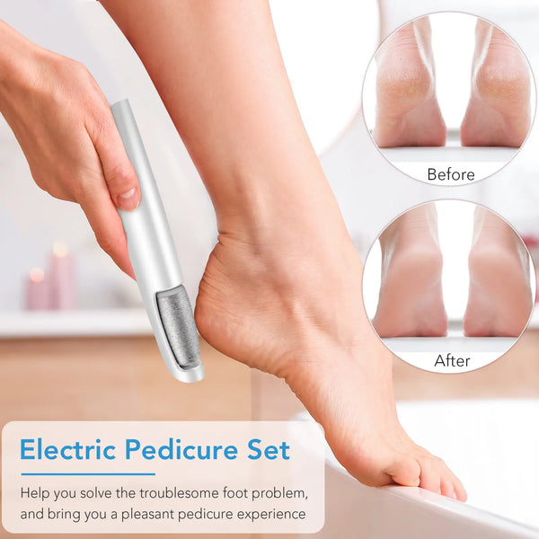 Electric Feet Callus Remover, Portable Foot File, Waterproof