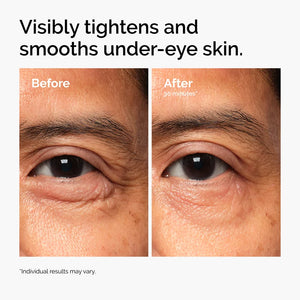 Lacto-PDRN 4% + B9 Eye Cream for Wrinkles, Fine Lines, Elasticity & Korean Skincare