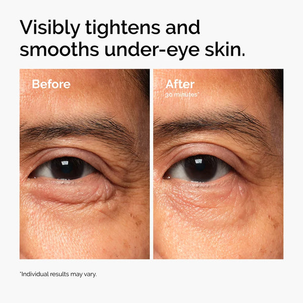 Lacto-PDRN 4% + B9 Eye Cream for Wrinkles, Fine Lines, Elasticity & Korean Skincare