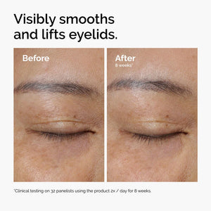 Lacto-PDRN 4% + B9 Eye Cream for Wrinkles, Fine Lines, Elasticity & Korean Skincare