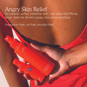 SOS Rescue Spray Hypochlorous Acid Facial Spray for Breakouts
